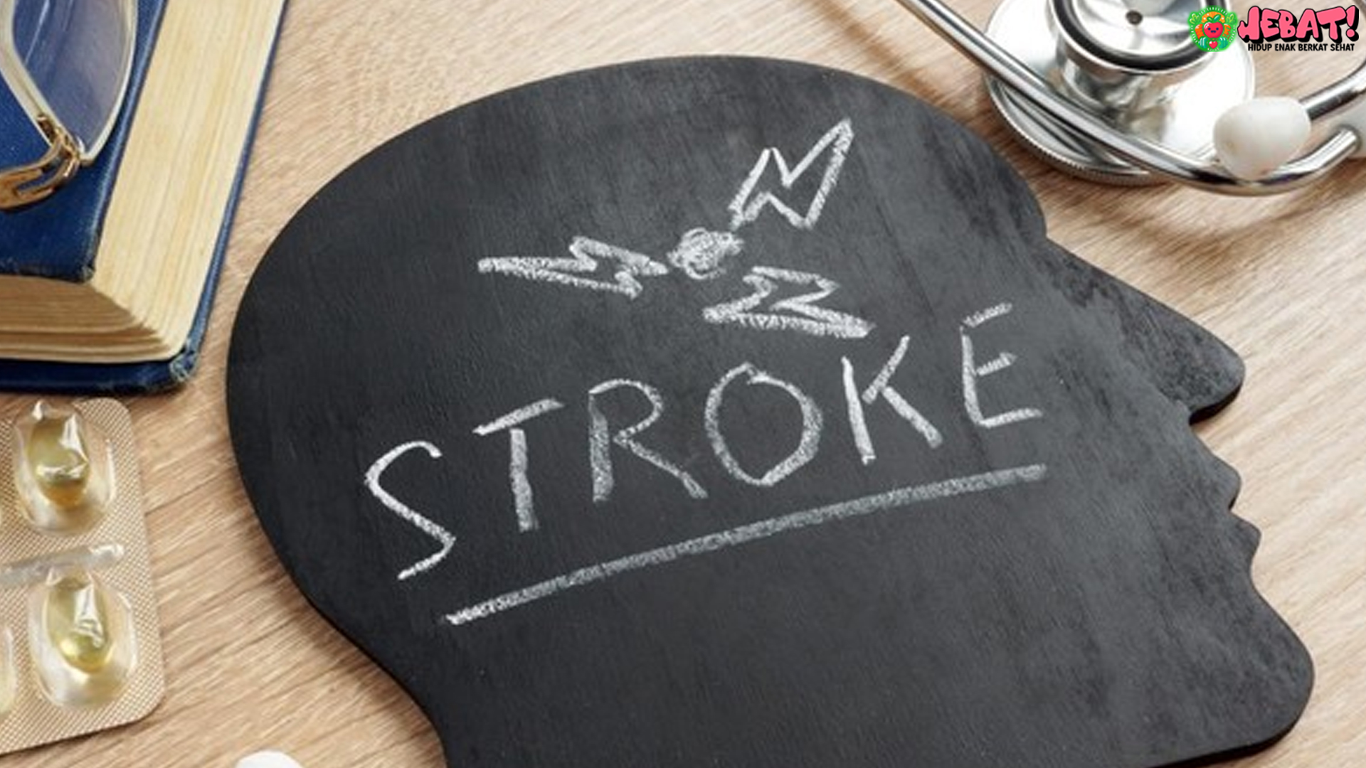 Stroke di Usia 21: Perjuangan Wanita Setelah Sakit Kepala Berat