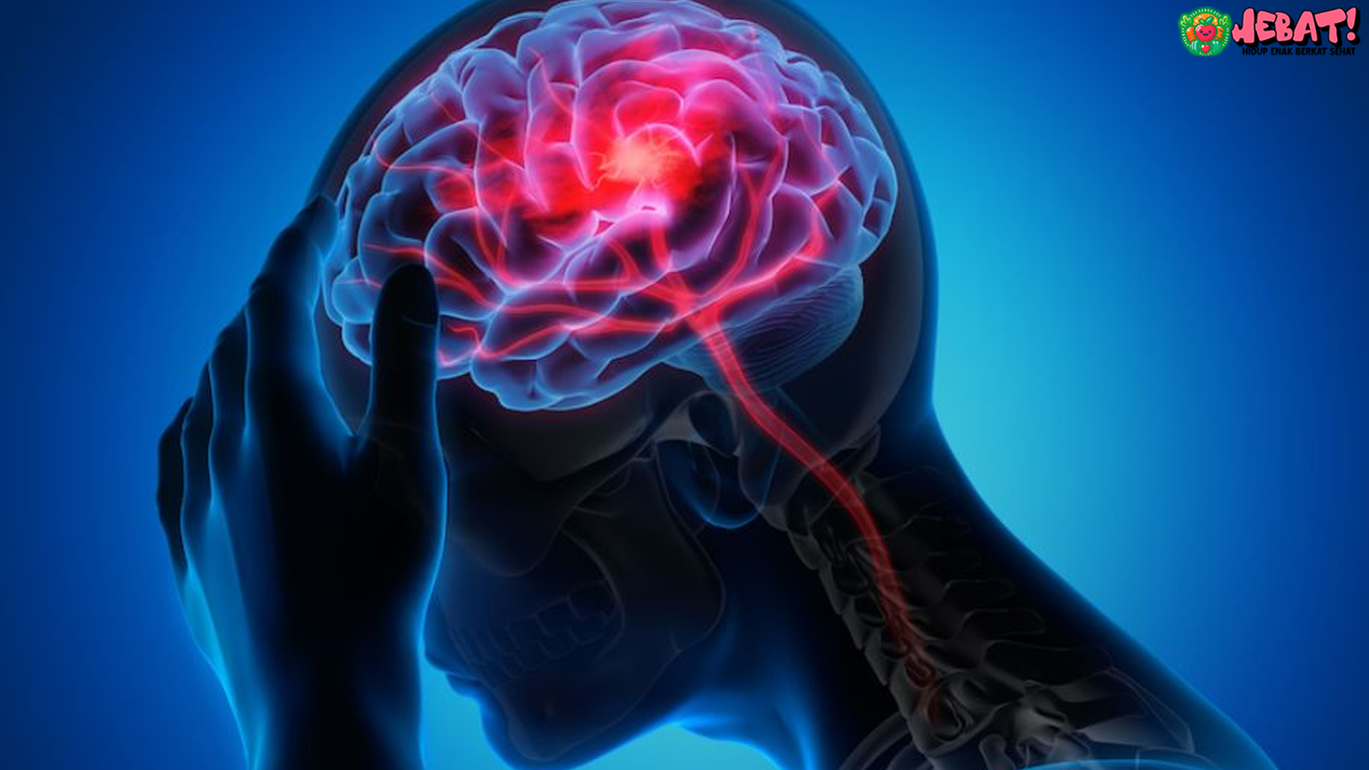 Bahaya Stroke Moyamoya: Kenali Kelainan Pembuluh Otak