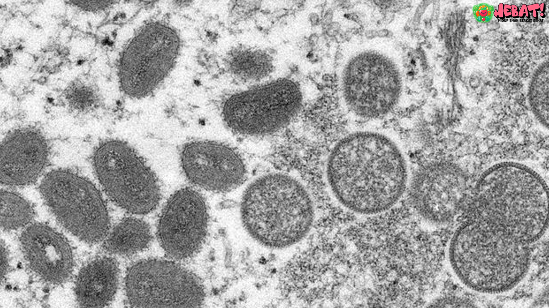 Kasus Mpox Meledak, WHO Nyatakan Darurat Kesehatan Dunia
