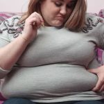 Obesitas Bisa Ganggu Kesehatan Mental? Temuan Ini Bikin Kaget!