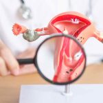 Pap Smear & Vaksin HPV: Investasi Kecil, Perlindungan Besar