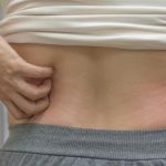 Gatal Malam Hari, Alarm Tersembunyi dari Organ Liver Anda