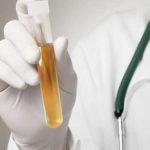 Urine Berubah? Bisa Jadi Itu Isyarat Ginjal Mulai Bermasalah