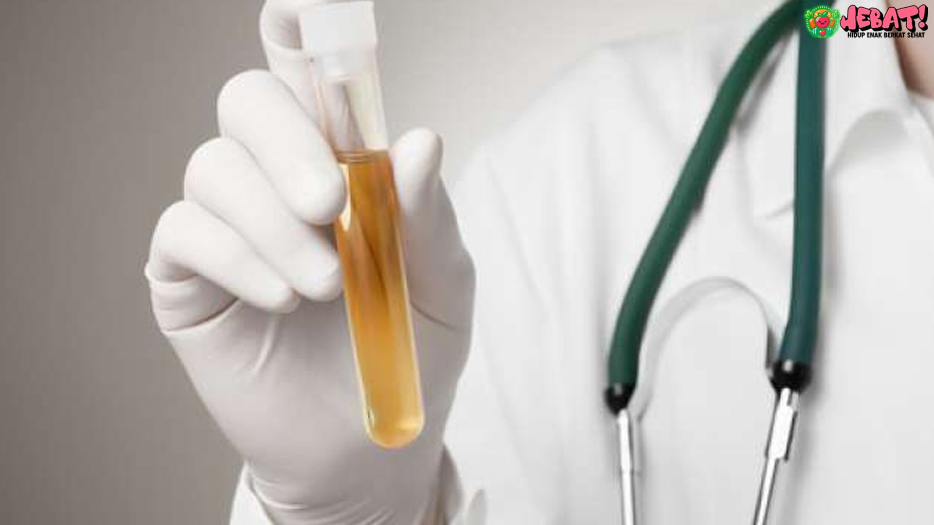 Urine Berubah? Bisa Jadi Itu Isyarat Ginjal Mulai Bermasalah