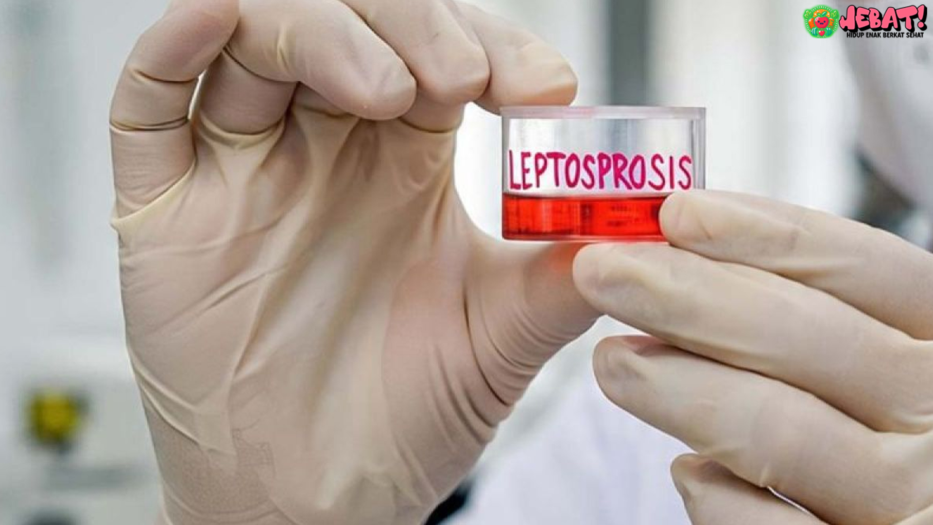 Kejadian Leptospirosis di Yogyakarta: 19 Kasus dan 6 Kematian