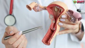 Informasi 4 Hal Penting Tentang Layanan Kanker dan Infeksi HPV
