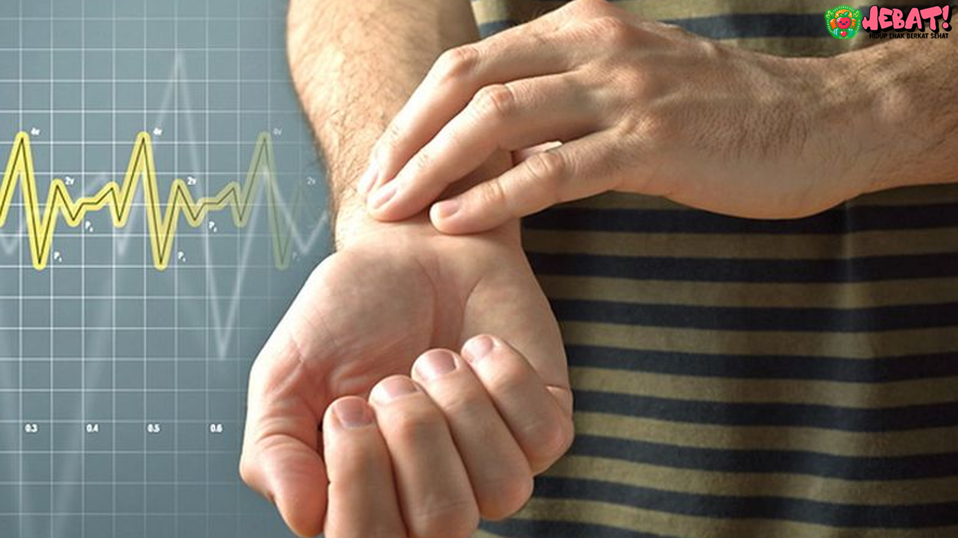 Fibrilasi Atrium: 5 Faktor Pemicu Stroke Mendadak pada Pasien