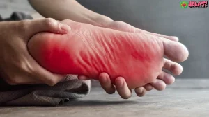 Panas di Telapak Kaki: 5 Alasan Kamu Harus Curiga Neuropati