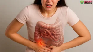 Pemicu Sumbatan Usus: 4 Faktor yang Harus Kamu Waspadai