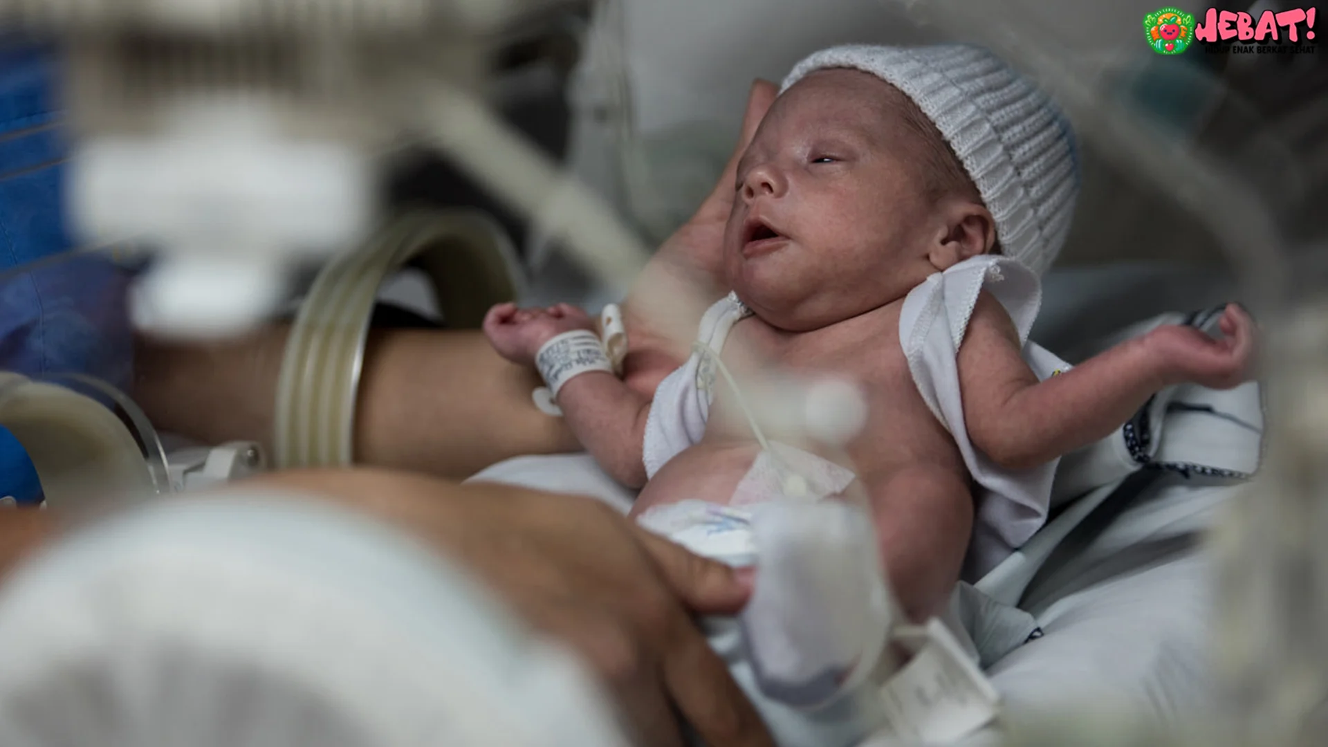 Infeksi Pernapasan dan 5 Tantangan Organ Paru di Bayi Prematu