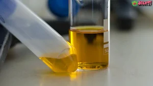 Warna Urine dan Gagal Ginjal: 5 Perubahan yang Perlu Kamu Tahu