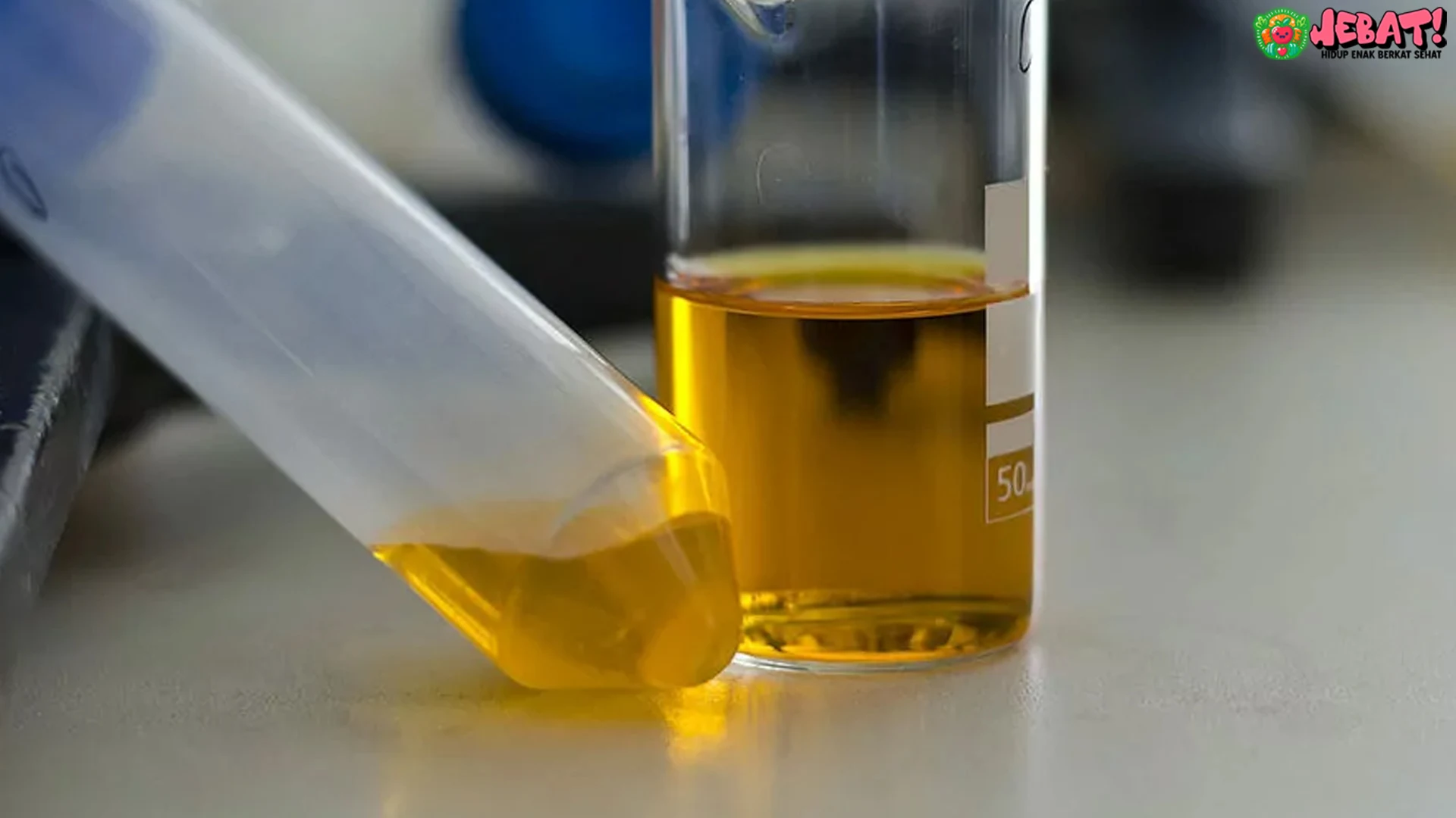 Warna Urine dan Gagal Ginjal: 5 Perubahan yang Perlu Kamu Tahu