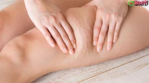 5 Ciri Tubuh Kehilangan Kolagen yang Perlu Diwaspadai Segera