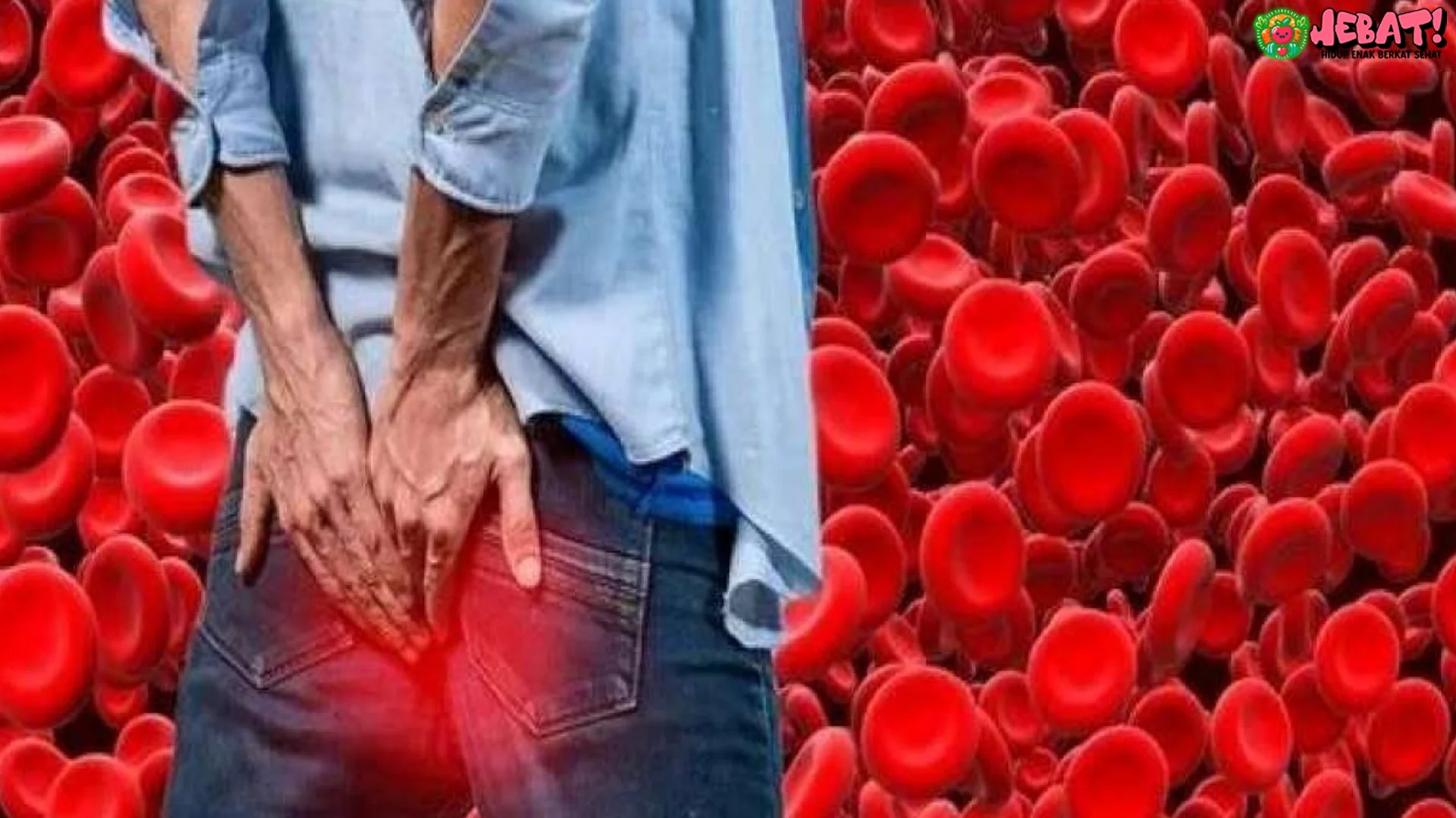 Studi Terbaru Ungkap Bentuk Bokong Menjadi Petunjuk 4 Risiko Diabetes