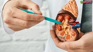 Keluhan Ini Bisa Jadi Pertanda Kanker Ginjal 4 Tingkat Risiko